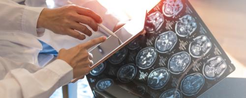 ARENSIA ENROLLS FIRST PATIENT WORLDWIDE IN COMPLEX MULTIPLE SCLEROSIS STUDY!