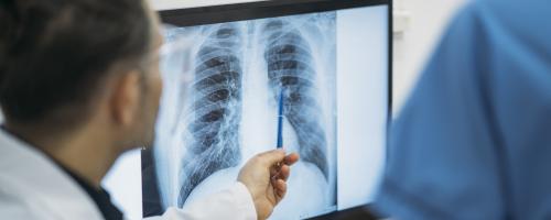 ARENSIA HAS SIGNIFICANTLY EXPEDITED A PHASE IB TRIAL FOR IDIOPATHIC PULMONARY FIBROSIS